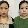 能让问题肌肤一步实现修复+抗衰的黑曜双波微针X，体验感超好！_图1