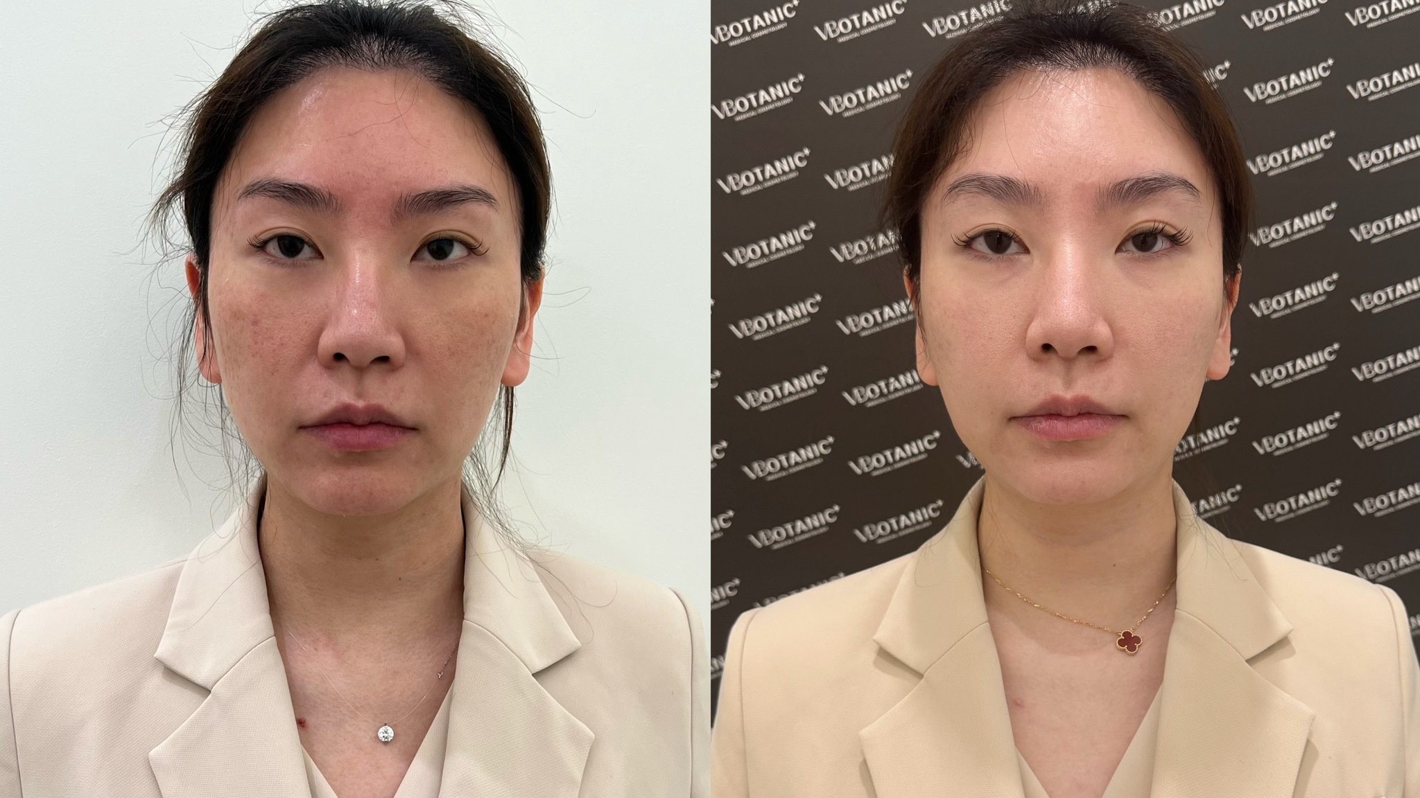 美颜美体推送