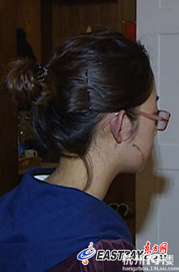 复旦女生被割脸案续:人民广场刀片男昨落网