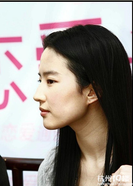 那些下颌角整形失败的明星!