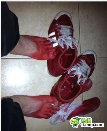 昨天在网上买的鞋 遇到下雨天成了这下场