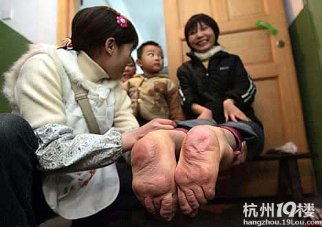 盘点超恐怖畸形人图