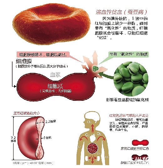 寶寶吃蠶豆會得蠶豆病大家注意啊