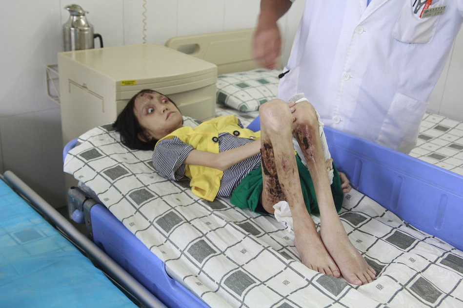 14岁少女患怪病 最想返回学校继续读书