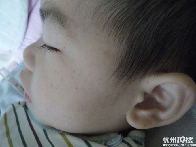 可怜，看了心痛！不捐没事，动动鼠标吧！请帮帮这个孩子！