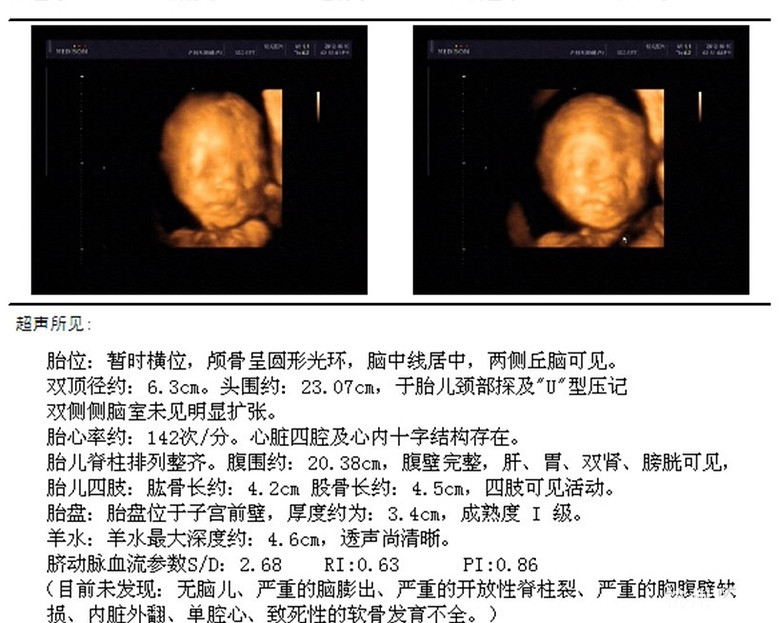 四维归来，猜男宝女宝