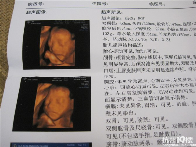 现代医疗：无痛人流中的关爱与选择