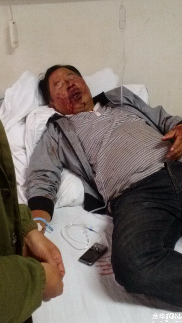华欣名都开发商打人,业主满脸是血!