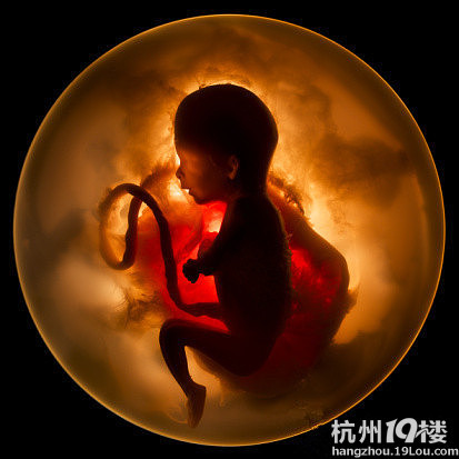 唐氏综合征筛查真让人揪心!