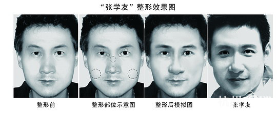 天王“张学友”也整容？