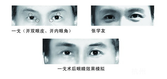 天王“张学友”也整容？