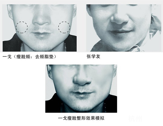 天王“张学友”也整容？
