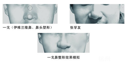 天王“张学友”也整容？