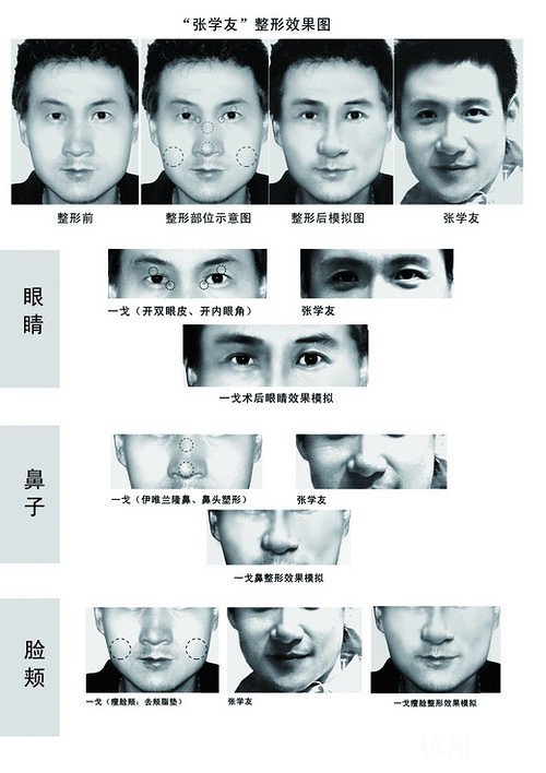 天王“张学友”也整容？