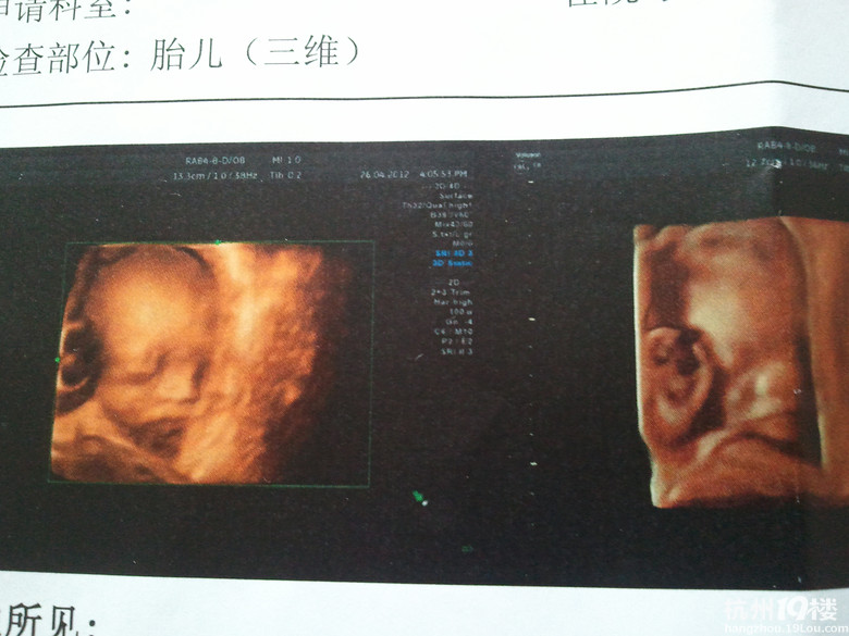 【雅布力孕妈日记】多宝妈的孕期小记