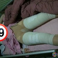 摆脱了“大象腿”！她更自信了！_图0