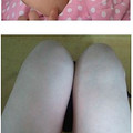 摆脱了“大象腿”！她更自信了！_图3