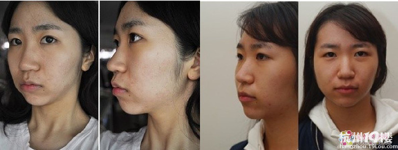 你们觉得有了下巴和美鼻之后的她漂亮吗？