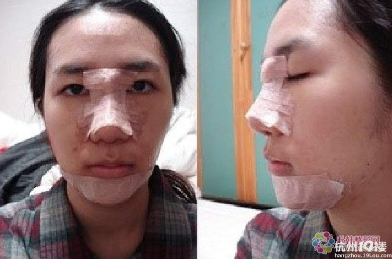 你们觉得有了下巴和美鼻之后的她漂亮吗？