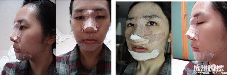 你们觉得有了下巴和美鼻之后的她漂亮吗？