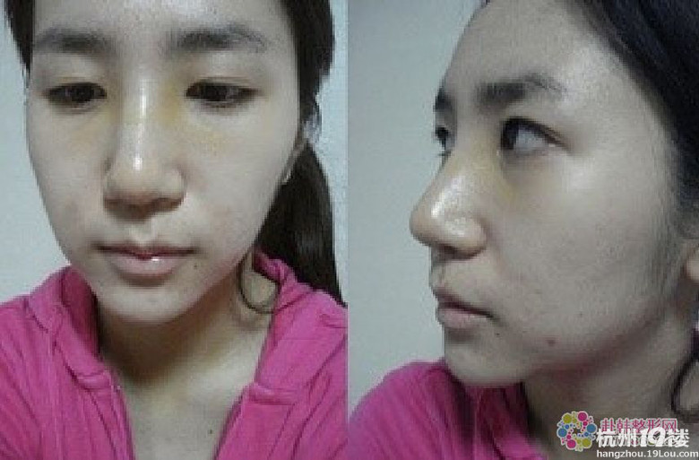 你们觉得有了下巴和美鼻之后的她漂亮吗？