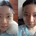 整形后记：真的年轻了呢！_图4