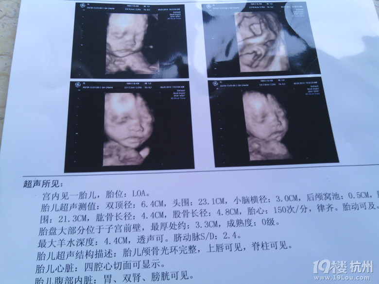 八十天胎儿图片图片