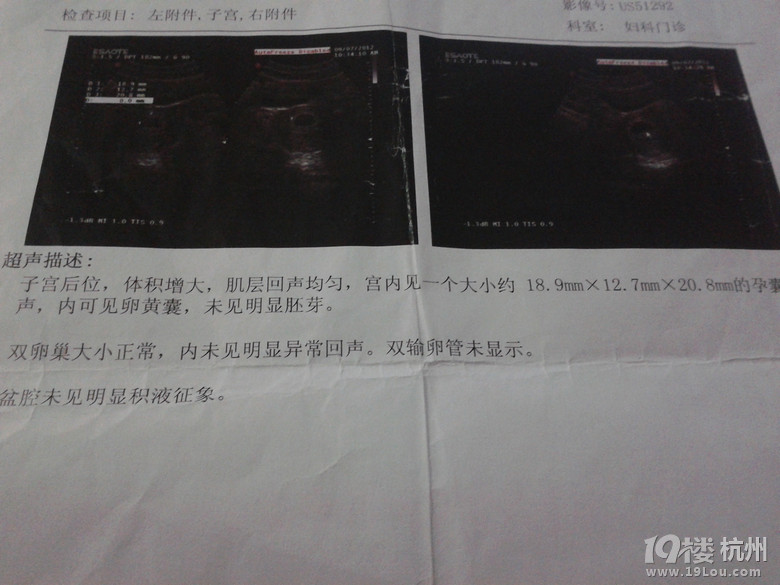 【雅布力孕妈日记】+大头妈妈的怀孕小记