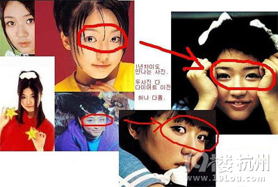 《想你》尹恩惠整容前后对比照(图)