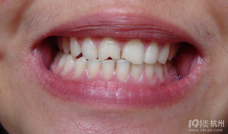 双莲牙膏---一个不可多得的好物