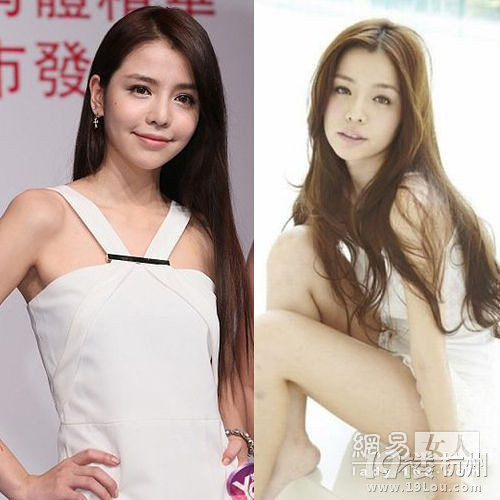 李毓芬又整容 揭“变脸”史撞脸多位明星