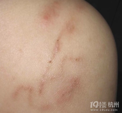 重口味寄生虫！慎入！黄鳝体内有要命的寄生虫？！