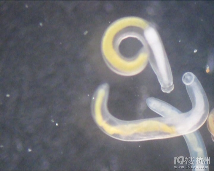 重口味寄生虫！慎入！黄鳝体内有要命的寄生虫？！