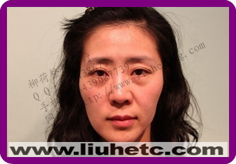 全面部提升手术价格_美容整形__杭州19楼