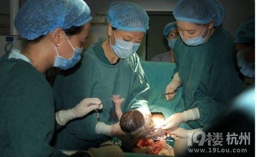 震撼!实拍四胞胎出生过程【图】