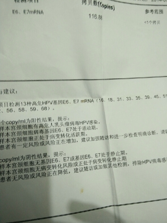 来姨妈乳房涨痛原来是这原因?妇科专家来帮你