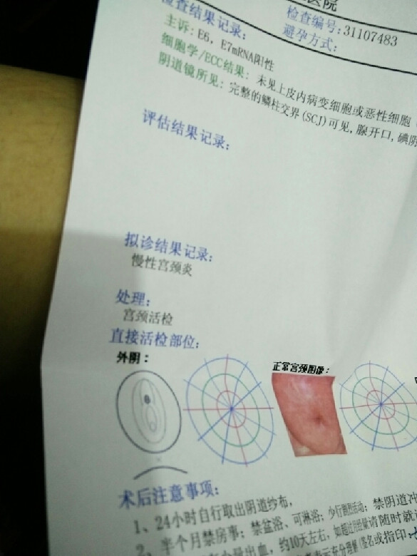 来姨妈乳房涨痛原来是这原因?妇科专家来帮你