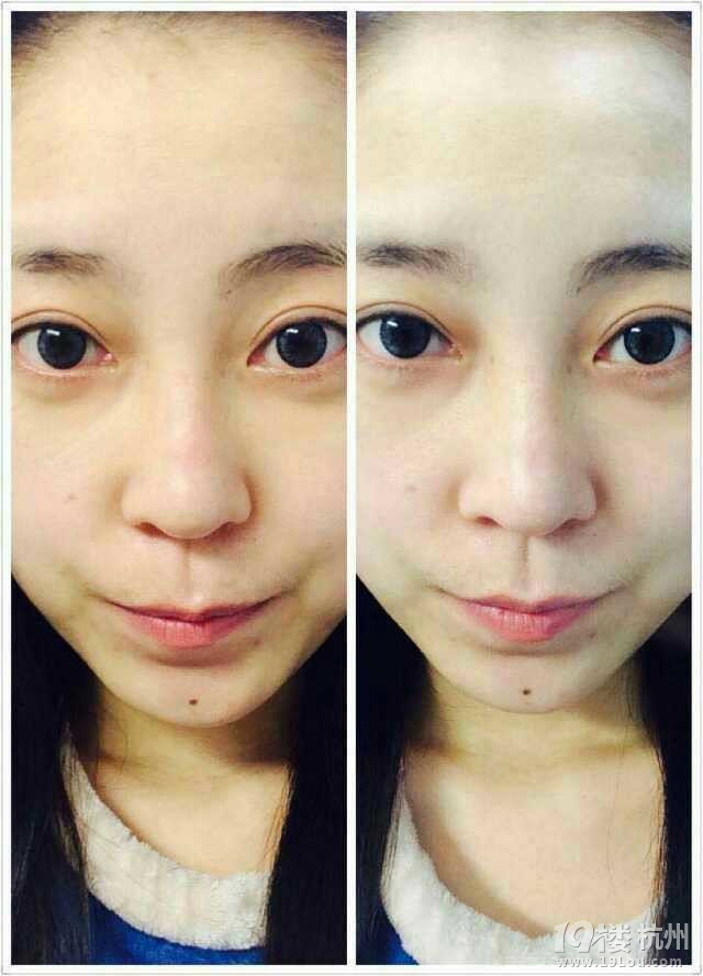 美白只需要7天我做到了,嘻嘻~~
