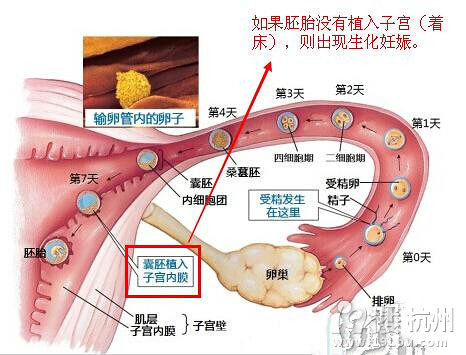 懷孕生化是什麼意思_生化妊娠後容易懷孕