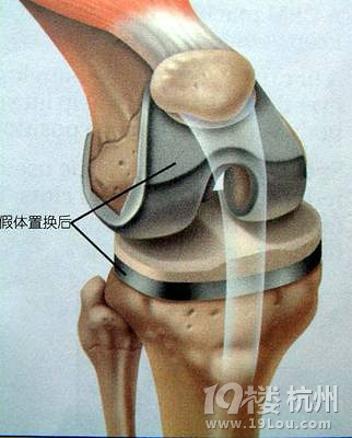 驴友容易产生的十大疾病!（未完待续）