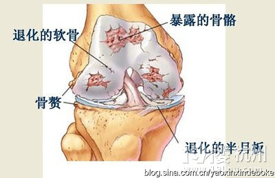 驴友容易产生的十大疾病!（未完待续）