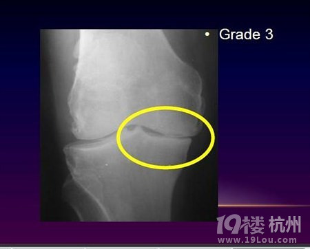 驴友容易产生的十大疾病!（未完待续）