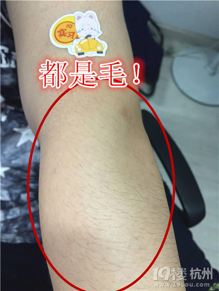 哪种脱毛方法最好?三种方法大pk!-论坛热议-女