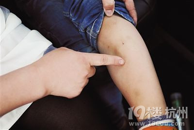 北京幼儿园老师用教棍打孩子 监控拍下打人情形