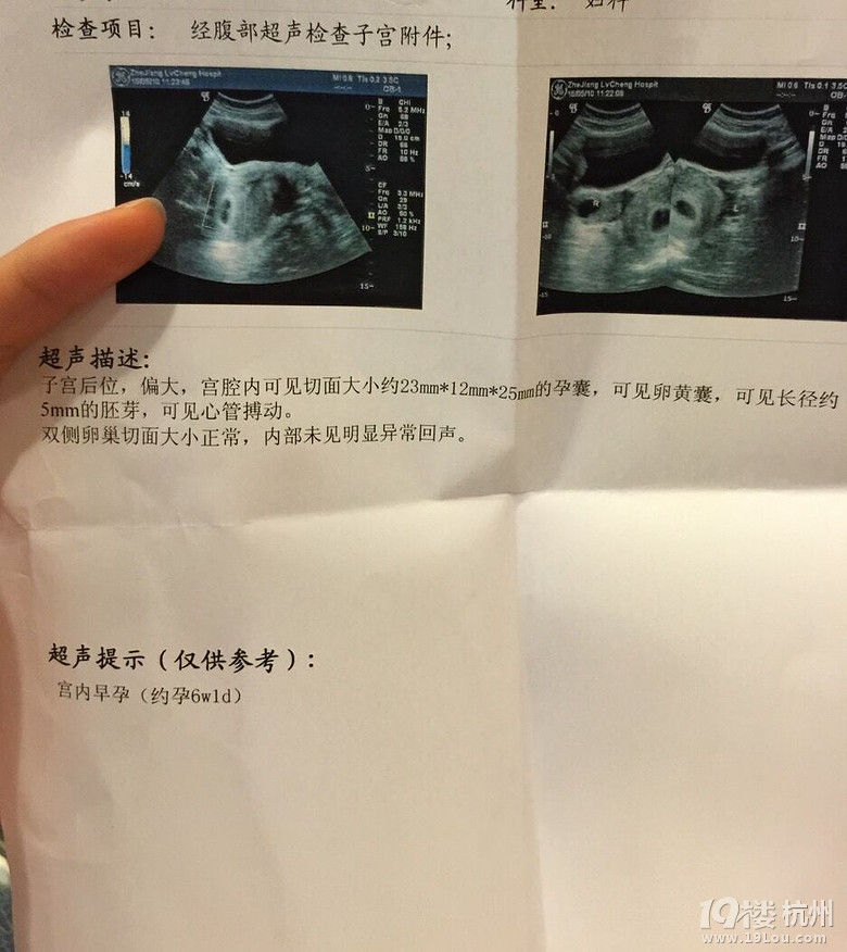 选择杭州人流医院：关注安全与便捷