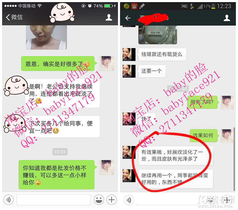 去痘印中药面膜★■什么中药面膜好用