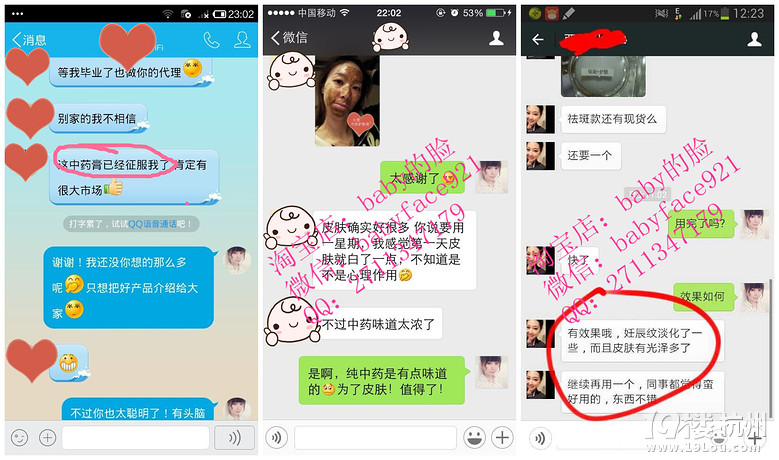 去痘印中药面膜★■什么中药面膜好用