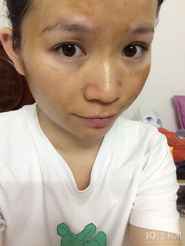 去痘印中药面膜★■什么中药面膜好用