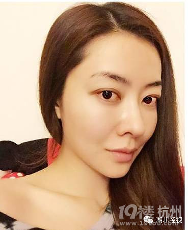 我没动过刀！女星否认整容也是蛮拼的！