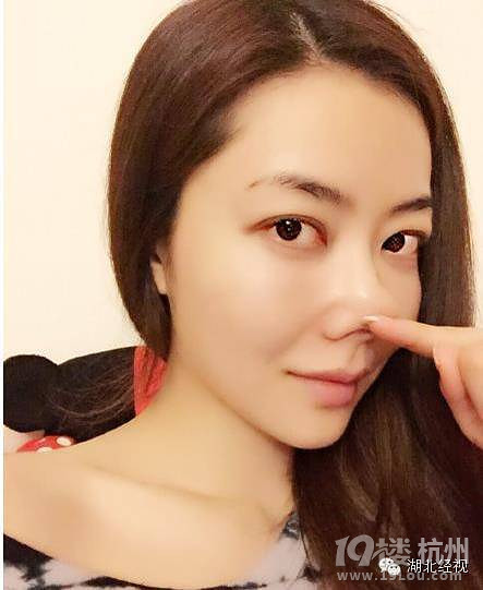 我没动过刀！女星否认整容也是蛮拼的！